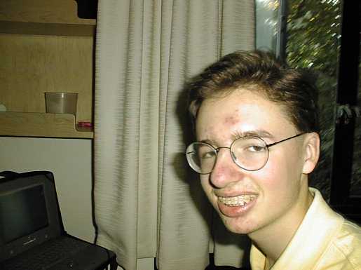drool.gif (2763 bytes)